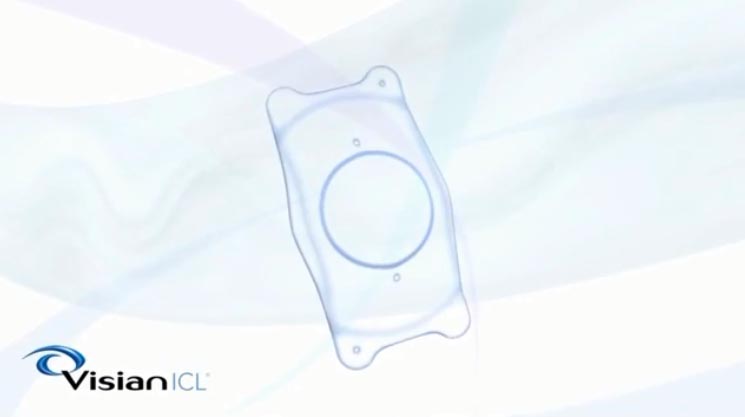 VISIAN ICL